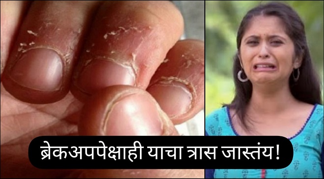 white part between the finger nails what is the called here is the answer -  बोटांच्या नखांमधील पांढर्‍या भागाला काय म्हणतात हे तज्ज्ञही सांगू शकणार  नाहीत | TimesNow Marathi